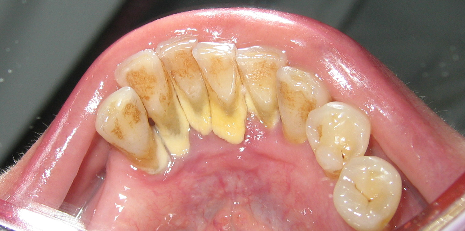 teeth